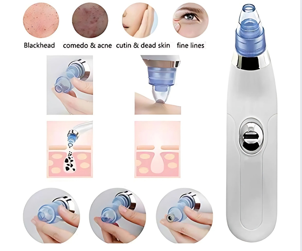 Blackhead Remover Machine vacuum tool for instant pore clearing and blackhead removal